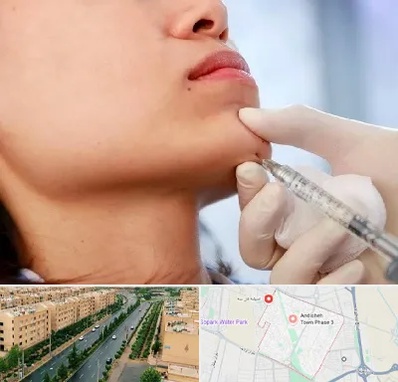 زاویه سازی صورت در فاز سه اندیشه