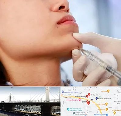 زاویه سازی صورت در پارک وی 