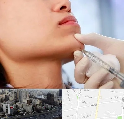 زاویه سازی صورت در زرتشت