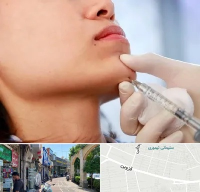 زاویه سازی صورت در خیابان قزوین