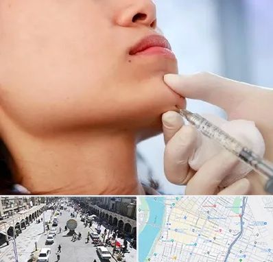 زاویه سازی صورت در نادری اهواز 