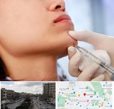 زاویه سازی صورت در بلوار فردوسی مشهد 