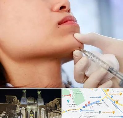 زاویه سازی صورت در زرگری شیراز 