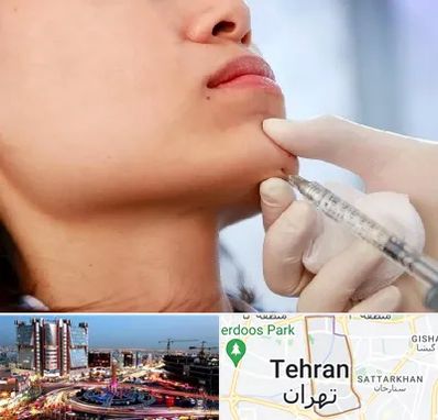 زاویه سازی صورت در صادقیه 