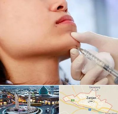 زاویه سازی صورت در زنجان