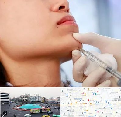 زاویه سازی صورت در میدان انقلاب 