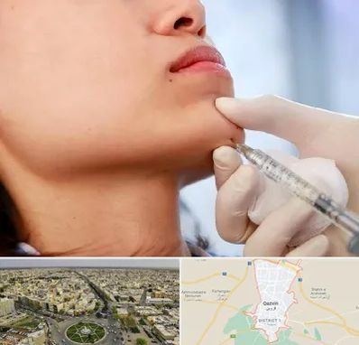 زاویه سازی صورت در قزوین