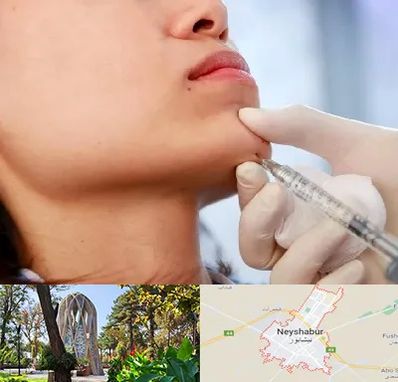 زاویه سازی صورت در نیشابور