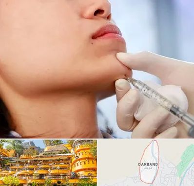 زاویه سازی صورت در دربند