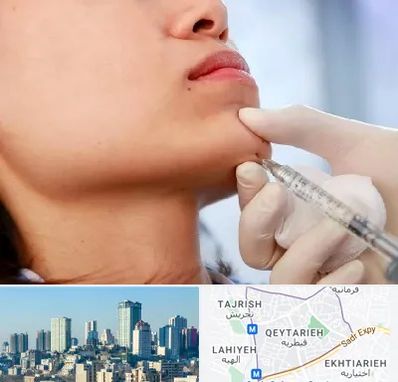 زاویه سازی صورت در قیطریه 