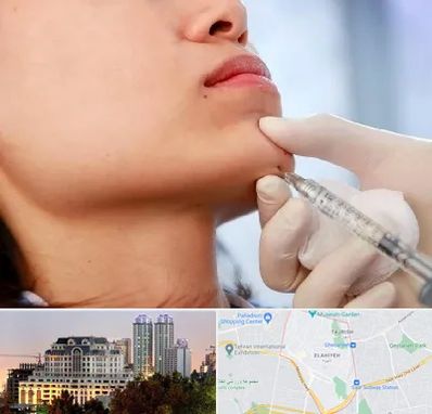 زاویه سازی صورت در فرشته 