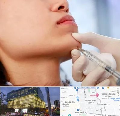 زاویه سازی صورت در جمهوری 