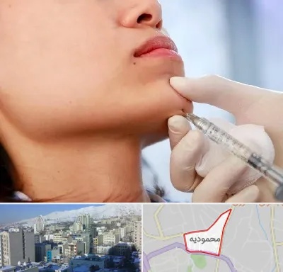 زاویه سازی صورت در محمودیه