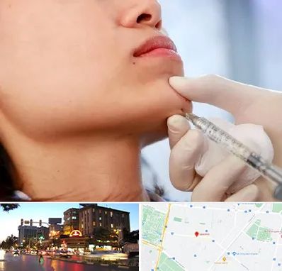 زاویه سازی صورت در بلوار سجاد مشهد 