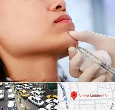 زاویه سازی صورت در مطهری تهران