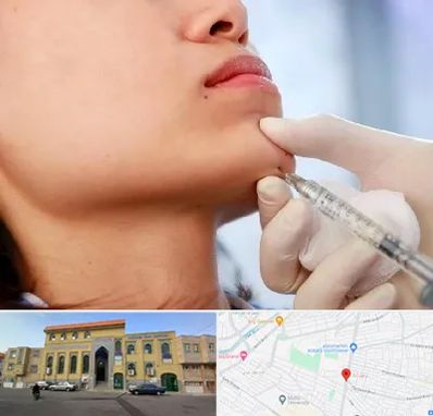 زاویه سازی صورت در زنبیل آباد قم