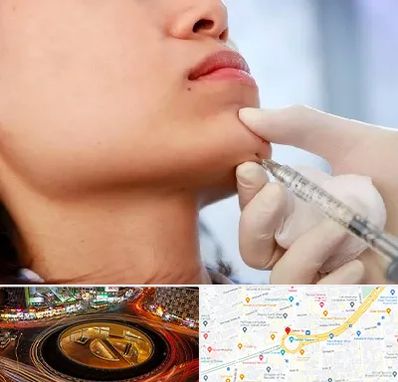 زاویه سازی صورت در میدان ولیعصر 