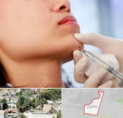 زاویه سازی صورت در جماران