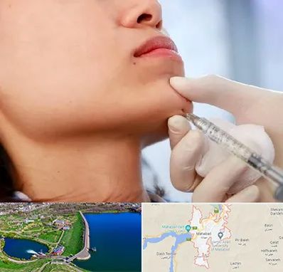 زاویه سازی صورت در مهاباد