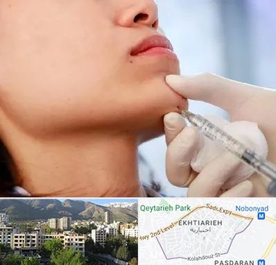 زاویه سازی صورت در اختیاریه 