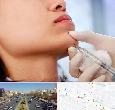 زاویه سازی صورت در بلوار معلم مشهد 