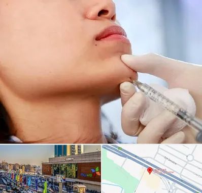 زاویه سازی صورت در لاله پارک تبریز