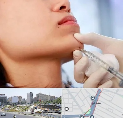 زاویه سازی صورت در هفت تیر