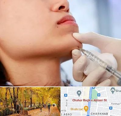 زاویه سازی صورت در چهارباغ اصفهان 