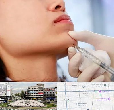 زاویه سازی صورت در مرکز تهران