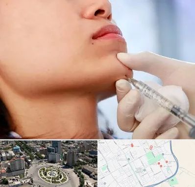 زاویه سازی صورت در زرافشان اسلامشهر