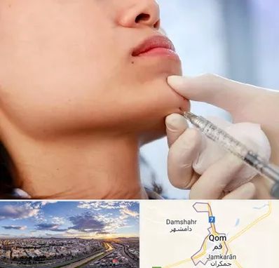 زاویه سازی صورت در قم