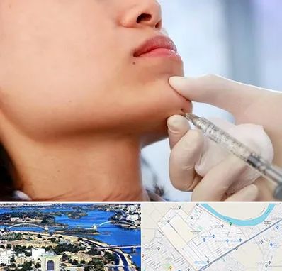 زاویه سازی صورت در کوروش اهواز 