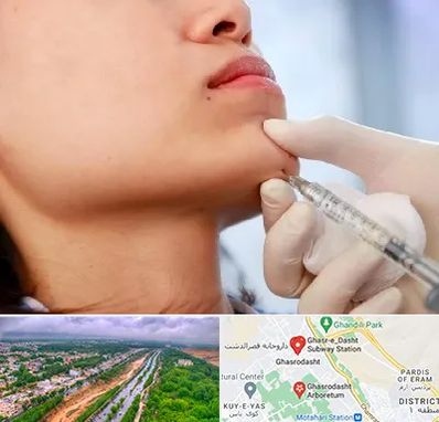 زاویه سازی صورت در قصرالدشت شیراز 