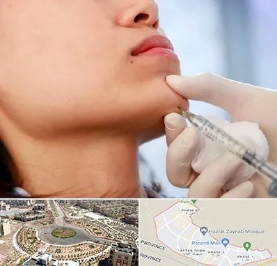 زاویه سازی صورت در پرند