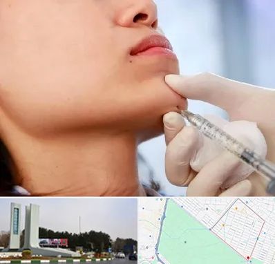 زاویه سازی صورت در بلوار فلسیطین مشهد