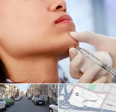 زاویه سازی صورت در مجیدیه شمالی