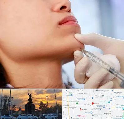 زاویه سازی صورت در میدان حر 