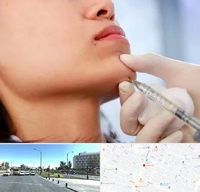 زاویه سازی صورت در بلوار کلاهدوز مشهد 