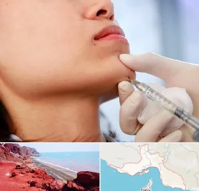 زاویه سازی صورت در هرمزگان