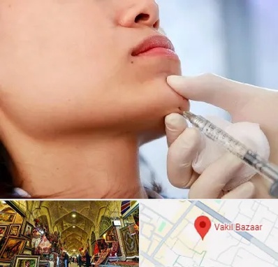 زاویه سازی صورت در بازار وکیل شیراز