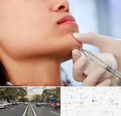 زاویه سازی صورت در دولت 