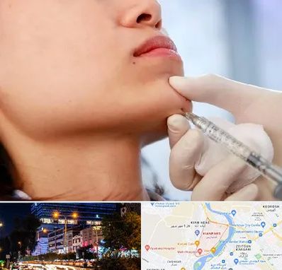 زاویه سازی صورت در کیانپارس اهواز 