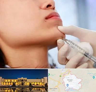 زاویه سازی صورت در برازجان