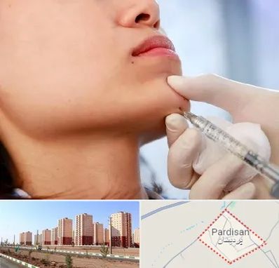 زاویه سازی صورت در پردیسان قم