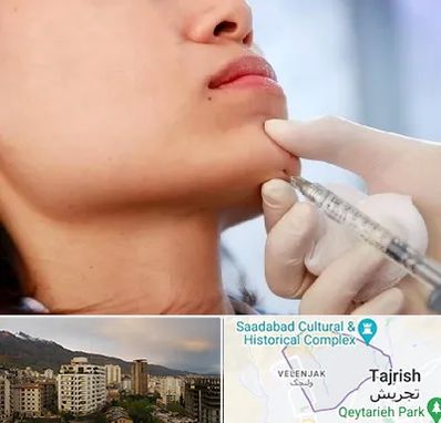 زاویه سازی صورت در زعفرانیه 