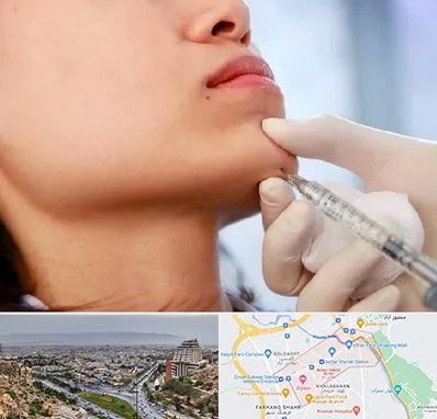 زاویه سازی صورت در معالی آباد شیراز 