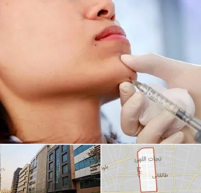 زاویه سازی صورت در نجات اللهی