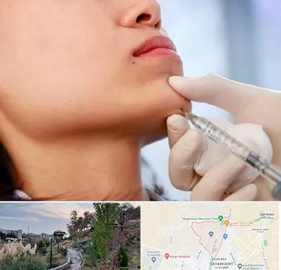 زاویه سازی صورت در باغستان کرج 