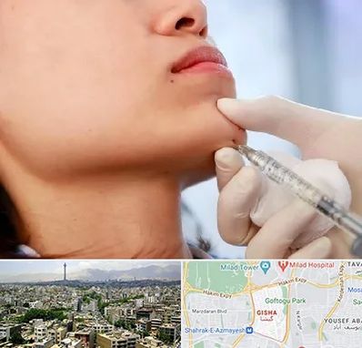 زاویه سازی صورت در گیشا 