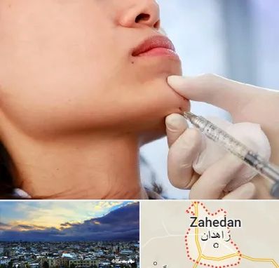 زاویه سازی صورت در زاهدان